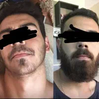 هرچی پرپشت تر جذاب تر