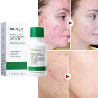 انواع سرم های پوستی(برای روشن شدن،از بین بردن جوش)