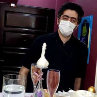 مزو تراپی پی آر پی رفع ریزش مو با دفترچه بیمه پرند