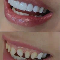 خدمات دندان پزشکی/شرایط اقساطی/کلینیک