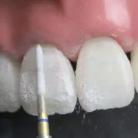 اموزش کامپوزیت