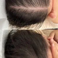 کمکت میکنم از افسردگی در بیای