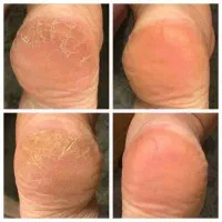 پدیکور|خدمات آرایشگری و زیبایی|دهلران, |دیوار
