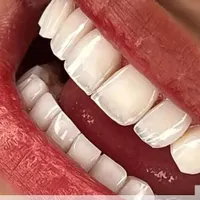 دندانپزشکی ماه دنتال|خدمات آرایشگری و زیبایی|تهران, نارمک جنوبی|دیوار