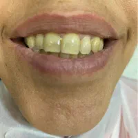 پروتز دندان کاظمی