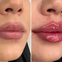 زیبایی و جوانسازی
