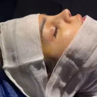 بینی|خدمات زیبایی و سلامت|دهدشت, |دیوار