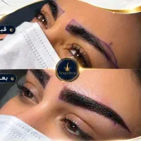 کاشت تخصصی ابرو