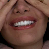 تخفیف ۲۰٪ کامپوزیت ونیر تا عید