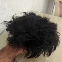پروتز مو دست دوم