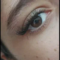 کاشت مژه
