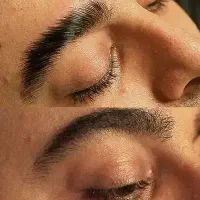 اجرا و آموزش حرفه‌ای لیفت (آقایان و بانوان)
