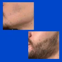 جنگلی شو|آرایشی، بهداشتی، درمانی|میاندوآب, |دیوار