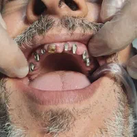 دندانپزشکی قیمت پایین کیفیت بالا