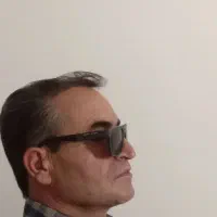 کاشت مو تضمینی