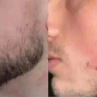 توعم اگه میخوای ریشاتو پرپشت کنی