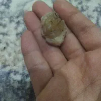 زوعه حیه