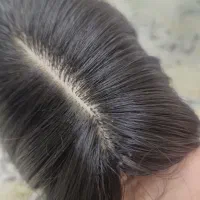 کف سر مو