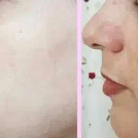 کرم معجزه  . چهل گیاه اماراتی سفید کننده قوی