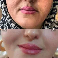 کرم صورت