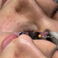 فیشال تخصصی ۱۶ مرحله تخفیف(800 تومان)اقا و خانم