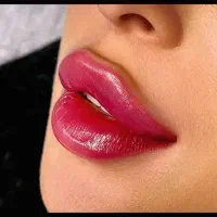 جشنواره همدلی فیلر ژل بوتاکس جوانساز PRP مزوتراپی