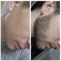 چهرتو پر کن با داشتن ریش