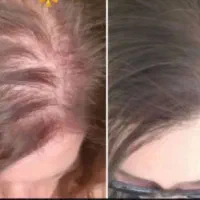 پی ار پی ممنوع