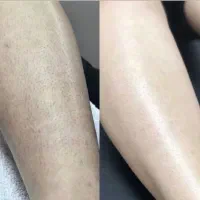 گلسانا کلینیک لیزر و زیبایی سنندج