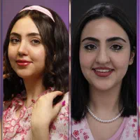 عمل بینی گوشتی و استخوانی / اقساط