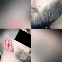 ریش کم‌پشت، راه‌حلش اینجاست