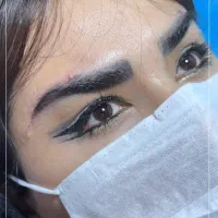 جراحی زیبایی لیپوساکشن لیفت سینه