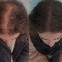 پکیج آلفا بی نظیره