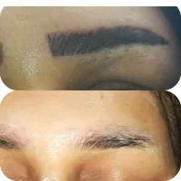 تضمینی تتوقدیمی ابروهاتوپاککن بایک جلسه ۷۰درصد3600