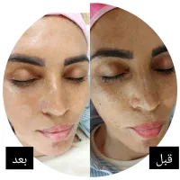 فیشیال تخصصی پوست