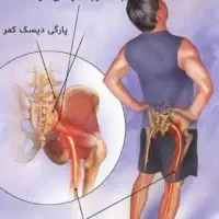 درمان درد سیاتیک، کمر درد زانو درد در یک جلسه