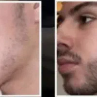 توام ریش نداری یا ریشات کم پشته