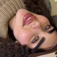 ژل و بوتاکس درکلینیک زیبایی480هزار(جشنواره ویژه)