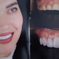 کلینیک دندانپزشکی پرسیکا / تخفیف ویژه ایام ولایت