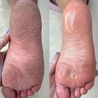 پدیکور پاکسازی دست تخصصی در کلینیک و آموزش.نوبهار