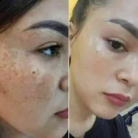 فروش کرم معجزه امارات اصل و کرم ماه