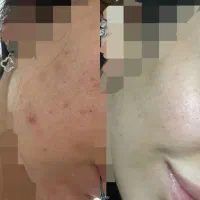 پوست بد ممنوع