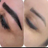 کاشت طبیعی و دائمی ابرو