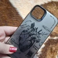 قاب ایفون۱۱ نرمال