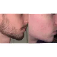 اعتماد به نفس با ریشی کامل