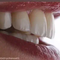استخدام همکار خانم جهت منشی مطب دندانسازی