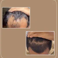 ریخت موهات من اینجام