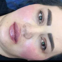 کلینیک زیبایی وکاشت مو/ ابرو (شهر سهند)