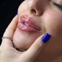 جشنواره ژل و بوتاکس آنزیم