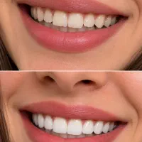 دندانپزشکی و دندانسازی